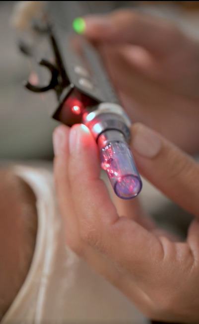 DERMAPEN FACIAL en Espai Vital