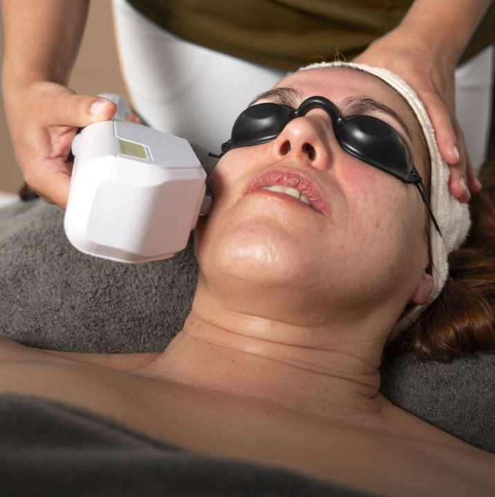 Rejuvenecimiento facial Láser DPL en Espai Vital