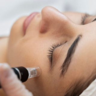 dermapen-medico-687x1024